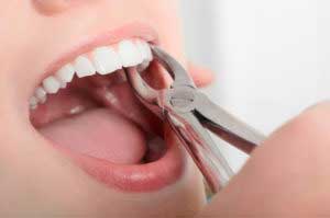 Dentist checking patient's teeth