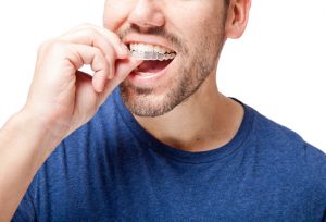 Young man wearing braces